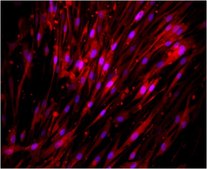 Anti-CD73 Antibody, clone AA60-E3-3, Cy3 Conjugate clone AA60-E3-3, from mouse, CY3 conjugate