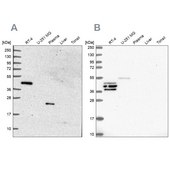 Anti-SPESP1 antibody produced in rabbit Prestige Antibodies® Powered by Atlas Antibodies, affinity isolated antibody, buffered aqueous glycerol solution