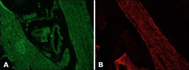 Anti-Desmin antibody, Mouse monoclonal clone DE-U-10, purified from hybridoma cell culture