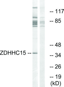 Anti-ZDHHC15 antibody produced in rabbit affinity isolated antibody