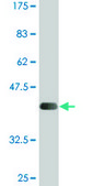 Monoclonal Anti-SLC26A2 antibody produced in mouse clone 3F6, purified immunoglobulin, buffered aqueous solution