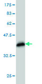 Monoclonal Anti-FBXO11 antibody produced in mouse clone 4C12, purified immunoglobulin, buffered aqueous solution