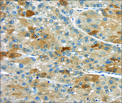 Anti-UPP2 affinity isolated antibody