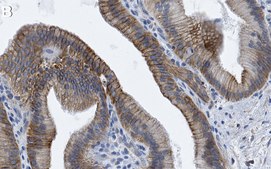 Anti-Parkin Antibody, clone 2J8 ZooMAb® Rabbit Monoclonal recombinant, expressed in HEK 293 cells