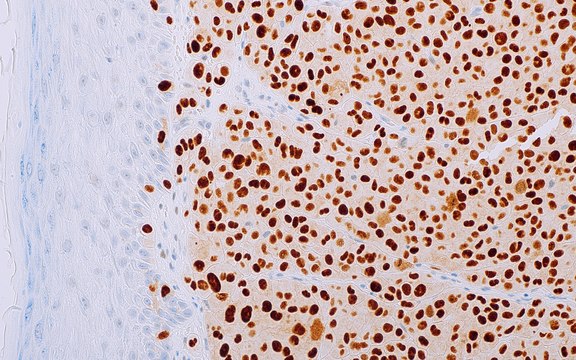 PRAME (EP461) Rabbit Monoclonal Primary Antibody