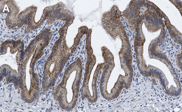 Anti-Parkin Antibody, clone 2J8 ZooMAb&#174; Rabbit Monoclonal recombinant, expressed in HEK 293 cells