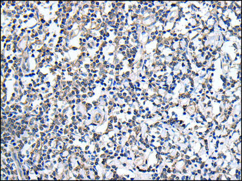 抗-PLAG1 affinity isolated antibody