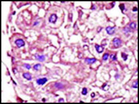 Anti-TGFBR1 (center) antibody produced in rabbit IgG fraction of antiserum, buffered aqueous solution