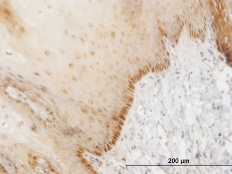 ANTI-HOXB7 antibody produced in mouse clone 4C6, purified immunoglobulin, buffered aqueous solution