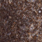 Anti-VPS37B antibody produced in rabbit Prestige Antibodies® Powered by Atlas Antibodies, affinity isolated antibody, buffered aqueous glycerol solution