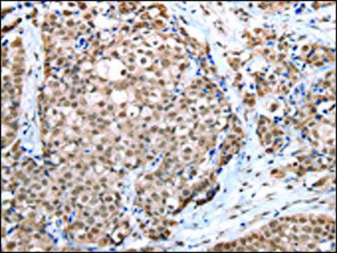 Anti-WDR5 affinity isolated antibody