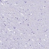 Anti-RBP3 antibody produced in rabbit Prestige Antibodies® Powered by Atlas Antibodies, affinity isolated antibody