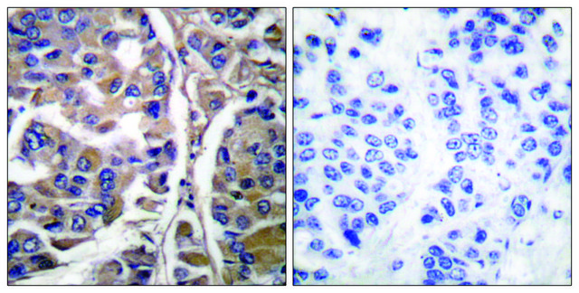 Anti-Keratin 20 antibody produced in rabbit affinity isolated antibody