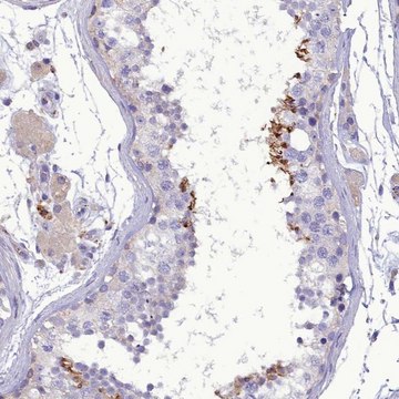 Anti-FAM149B1 antibody produced in rabbit Prestige Antibodies&#174; Powered by Atlas Antibodies, affinity isolated antibody, buffered aqueous glycerol solution