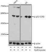 Anti-Phospho-p53-S392 antibody produced in rabbit