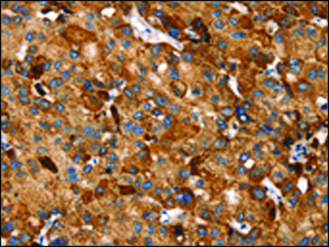 Anti-SLC27A5 affinity isolated antibody