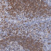 Anti-CD180 antibody produced in rabbit Prestige Antibodies® Powered by Atlas Antibodies, affinity isolated antibody, buffered aqueous glycerol solution