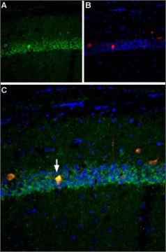 Anti-Sodium Channel PN4 antibody produced in rabbit affinity isolated antibody, lyophilized powder