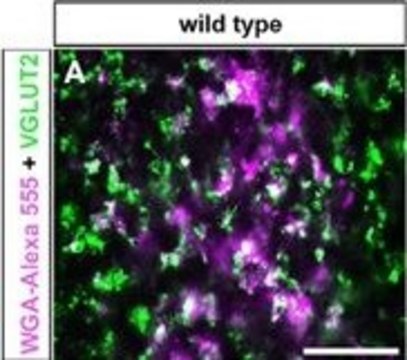 Anti-Vesicular Glutamate Transporter 2 Antibody clone 8G9.2, Chemicon&#174;, from mouse