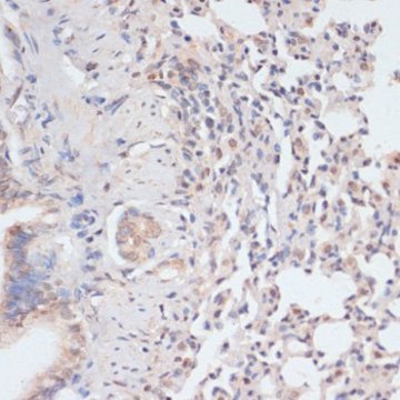 Anti-Phospho-STAT1-S727 antibody produced in rabbit