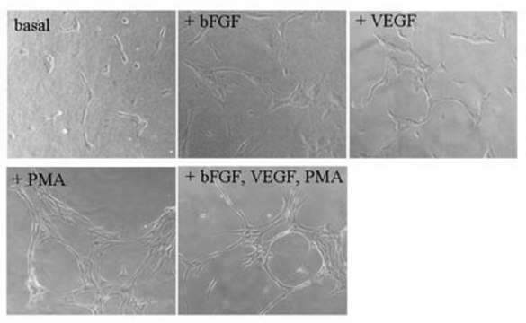 纤维蛋白体外血管生成检测 The Fibrin Gel In Vitro Angiogenesis Assay Kit represents a simple model of angiogenesis in which the induction or inhibition of tube formation by exogenous signals can be easily monitored.