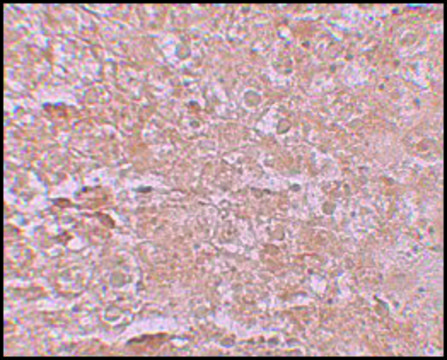 Anti-ZIP14 antibody produced in rabbit affinity isolated antibody, buffered aqueous solution