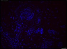 Anti-TRA-1-81 Antibody, clone TRA-1-81, Cy3 conjugate clone TRA-1-81, from mouse, CY3 conjugate