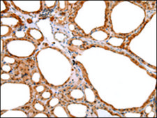 Anti-DEFB4A affinity isolated antibody