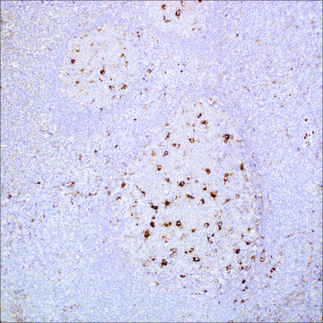 A-1-Antitrypsin Rabbit Polyclonal Antibody