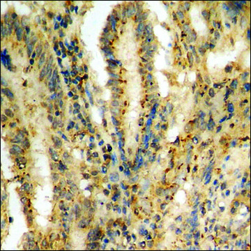 Anti-phospho-IkappaB-&#945; (pSer32/36) antibody produced in rabbit affinity isolated antibody