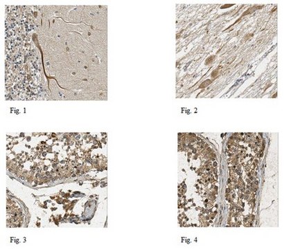 Anti-Protocadherin-10 Antibody from rabbit, purified by affinity chromatography