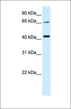 Anti-QPCTL antibody produced in rabbit affinity isolated antibody