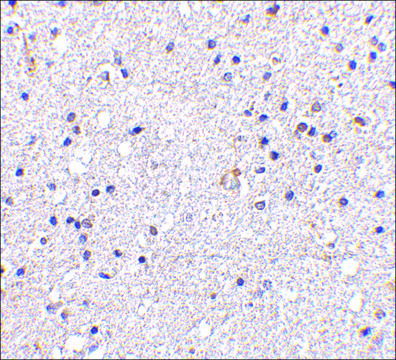 Anti-VISA (ab1) antibody produced in rabbit affinity isolated antibody, buffered aqueous solution