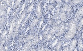 Anti-DR5/CD262 Antibody, clone 1B19 ZooMAb® Rabbit Monoclonal recombinant, expressed in HEK 293 cells