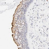 Anti-CYP4B1 antibody produced in rabbit Prestige Antibodies® Powered by Atlas Antibodies, affinity isolated antibody, buffered aqueous glycerol solution