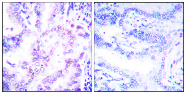 Anti-Thyroid Hormone Receptor &#946;, N-Terminal antibody produced in rabbit affinity isolated antibody