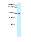 Anti-ITGB1BP2 antibody produced in rabbit IgG fraction of antiserum
