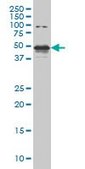 Monoclonal Anti-STK38 antibody produced in mouse clone 2F3, purified immunoglobulin, buffered aqueous solution