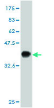 ANTI-KIT antibody produced in mouse clone 5A11, purified immunoglobulin, buffered aqueous solution