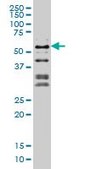 Monoclonal Anti-NFIC antibody produced in mouse clone 1D6, purified immunoglobulin, buffered aqueous solution