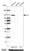 Anti-ACLY antibody produced in rabbit Prestige Antibodies® Powered by Atlas Antibodies, affinity isolated antibody, buffered aqueous glycerol solution, Ab1