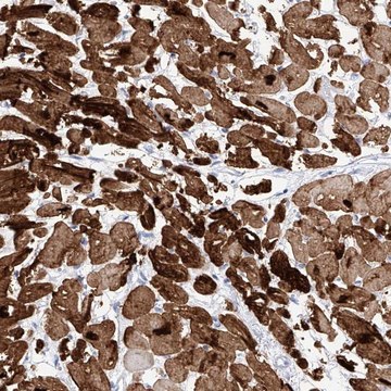 Anti-TRPC7 antibody produced in rabbit Prestige Antibodies&#174; Powered by Atlas Antibodies, affinity isolated antibody, buffered aqueous glycerol solution