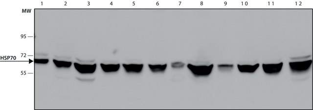 抗 热休克蛋白 70 (HSP70) 抗体，小鼠单克隆 clone BRM-22, purified from hybridoma cell culture