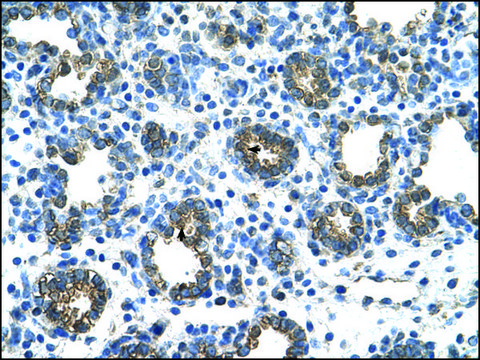 Anti-GUSB antibody produced in rabbit IgG fraction of antiserum