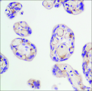 Anti-FLK-1 (mouse) antibody, Rabbit monoclonal clone SP123, recombinant, expressed in proprietary host, affinity isolated antibody