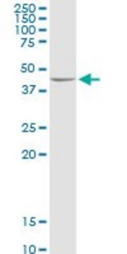 Anti-ADHFE1 antibody produced in rabbit purified immunoglobulin, buffered aqueous solution