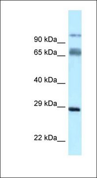 Anti-PRRT1 antibody produced in rabbit affinity isolated antibody