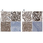 Anti-MARC2 antibody produced in rabbit Prestige Antibodies® Powered by Atlas Antibodies, affinity isolated antibody, buffered aqueous glycerol solution