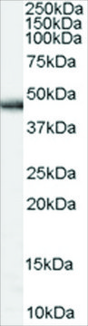 Anti-PARK2 antibody produced in goat affinity isolated antibody, buffered aqueous solution