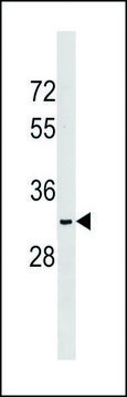 ANTI-NKX6-2 (N-TERM) antibody produced in rabbit IgG fraction of antiserum, buffered aqueous solution